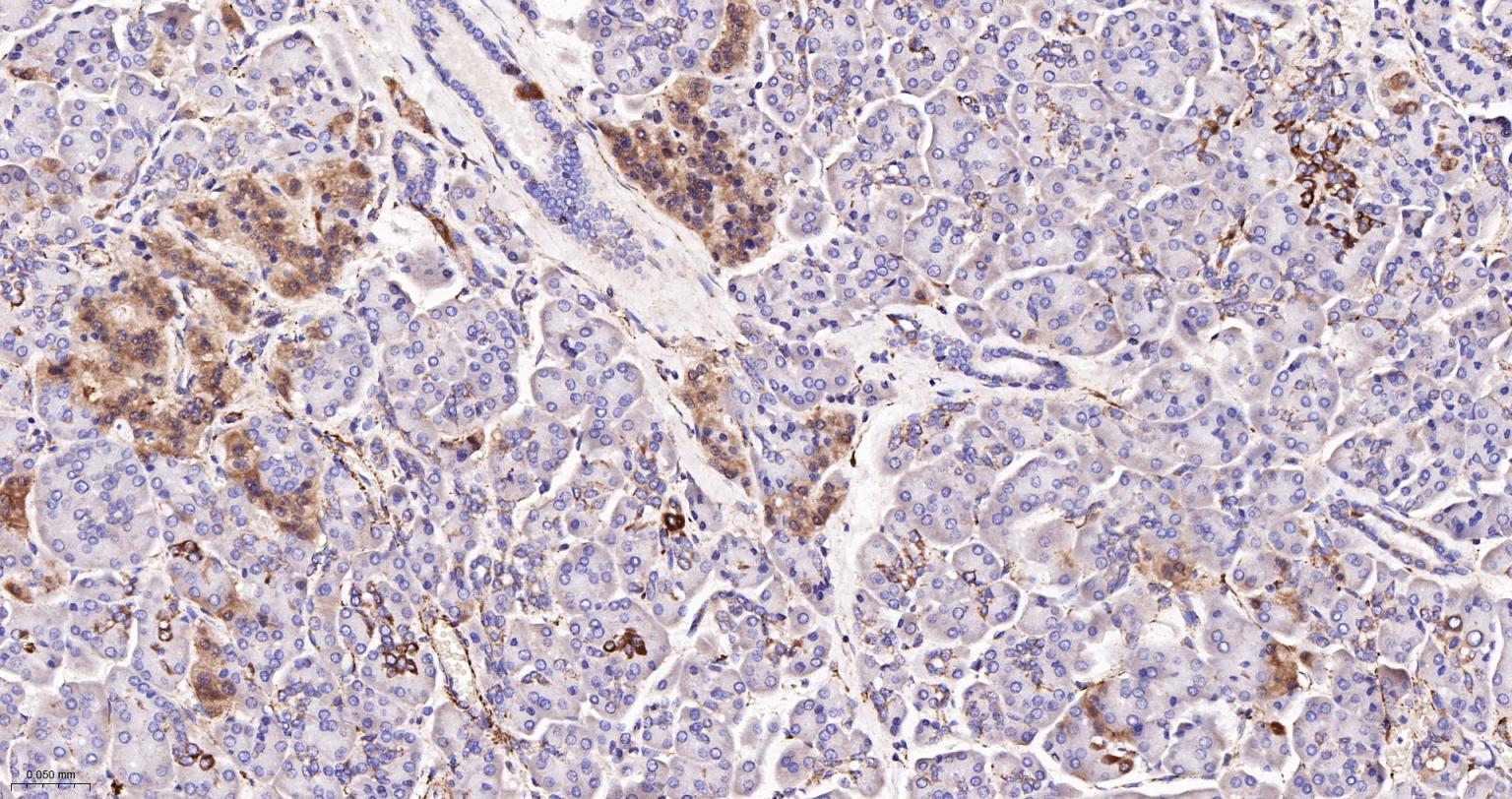 己糖激酶1重组兔单抗