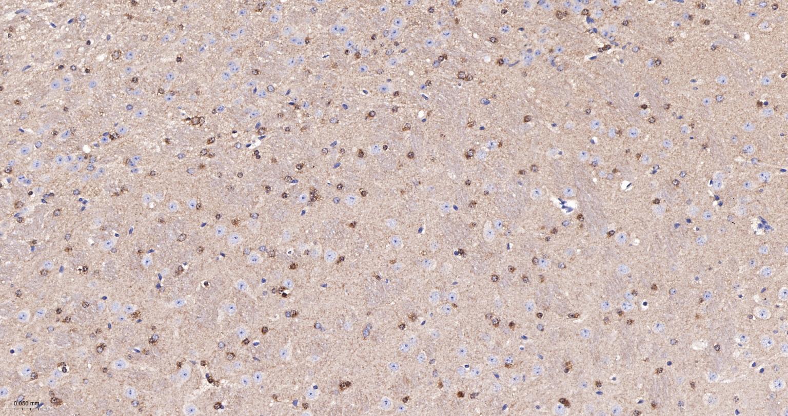 乙酰辅酶A羧化酶重组兔单抗