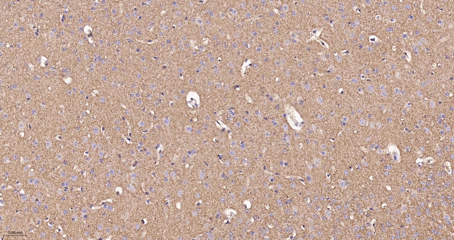 己糖激酶1重组兔单抗