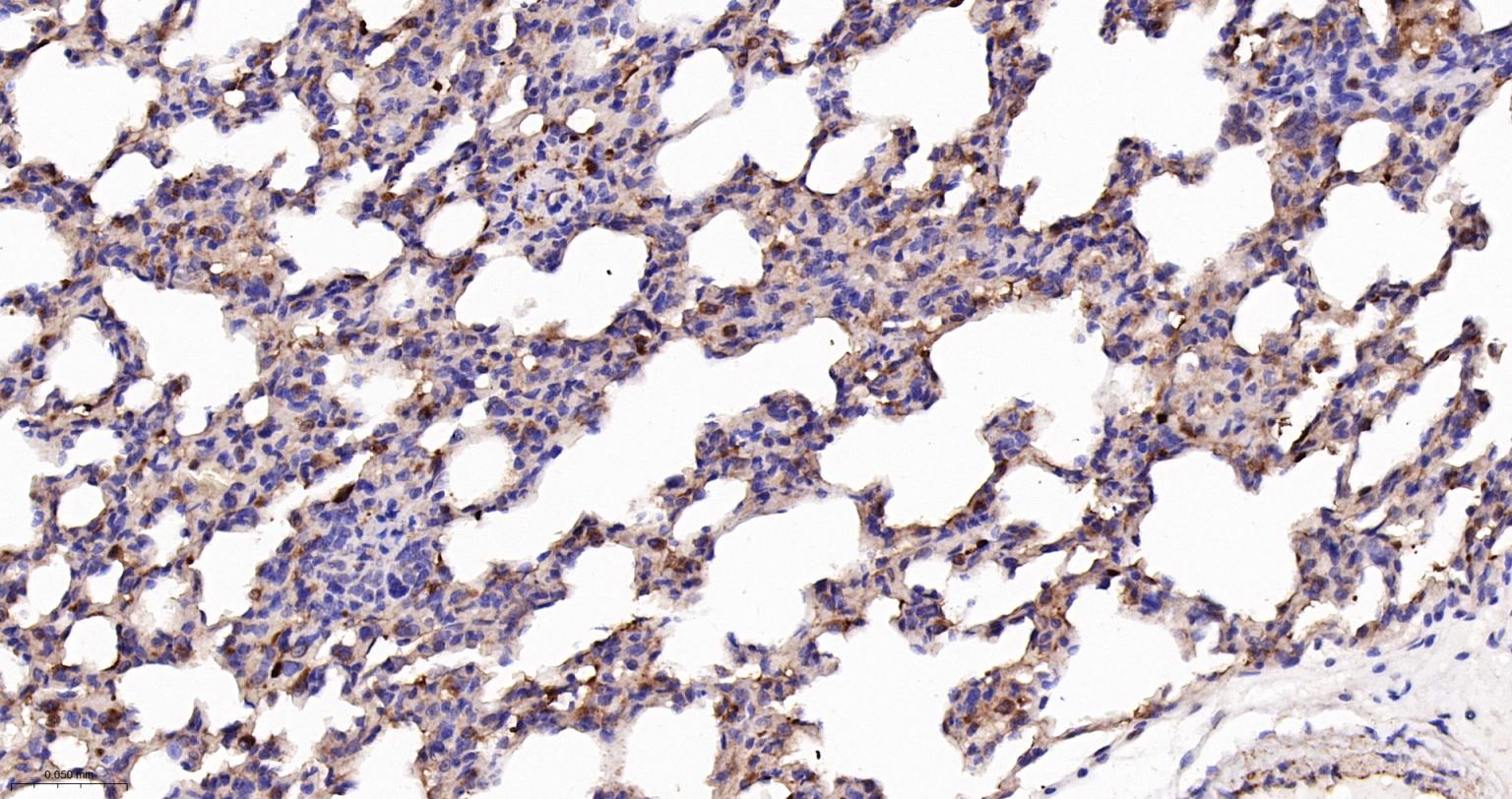 乙酰辅酶A羧化酶重组兔单抗