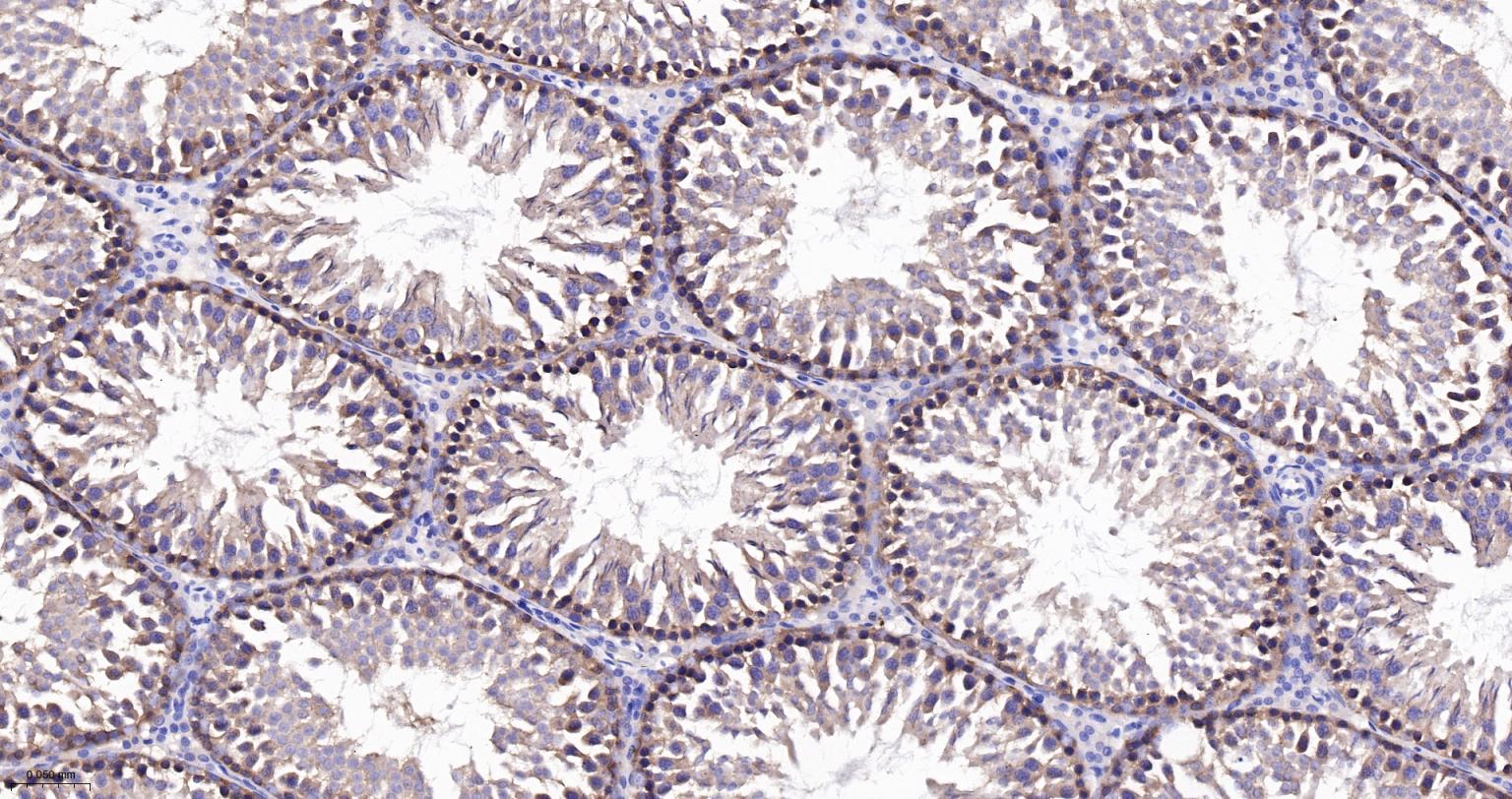 神经性舞蹈病蛋白重组兔单抗