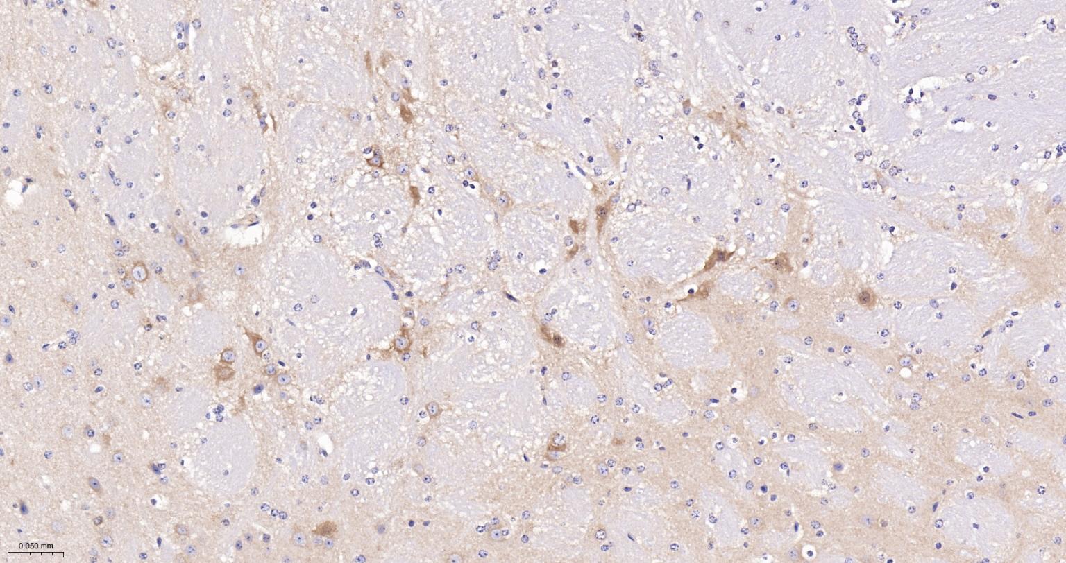 神经性舞蹈病蛋白重组兔单抗