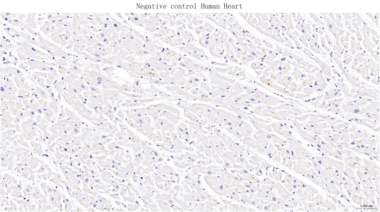 FCER2/CD23单克隆抗体-bsm-43216M