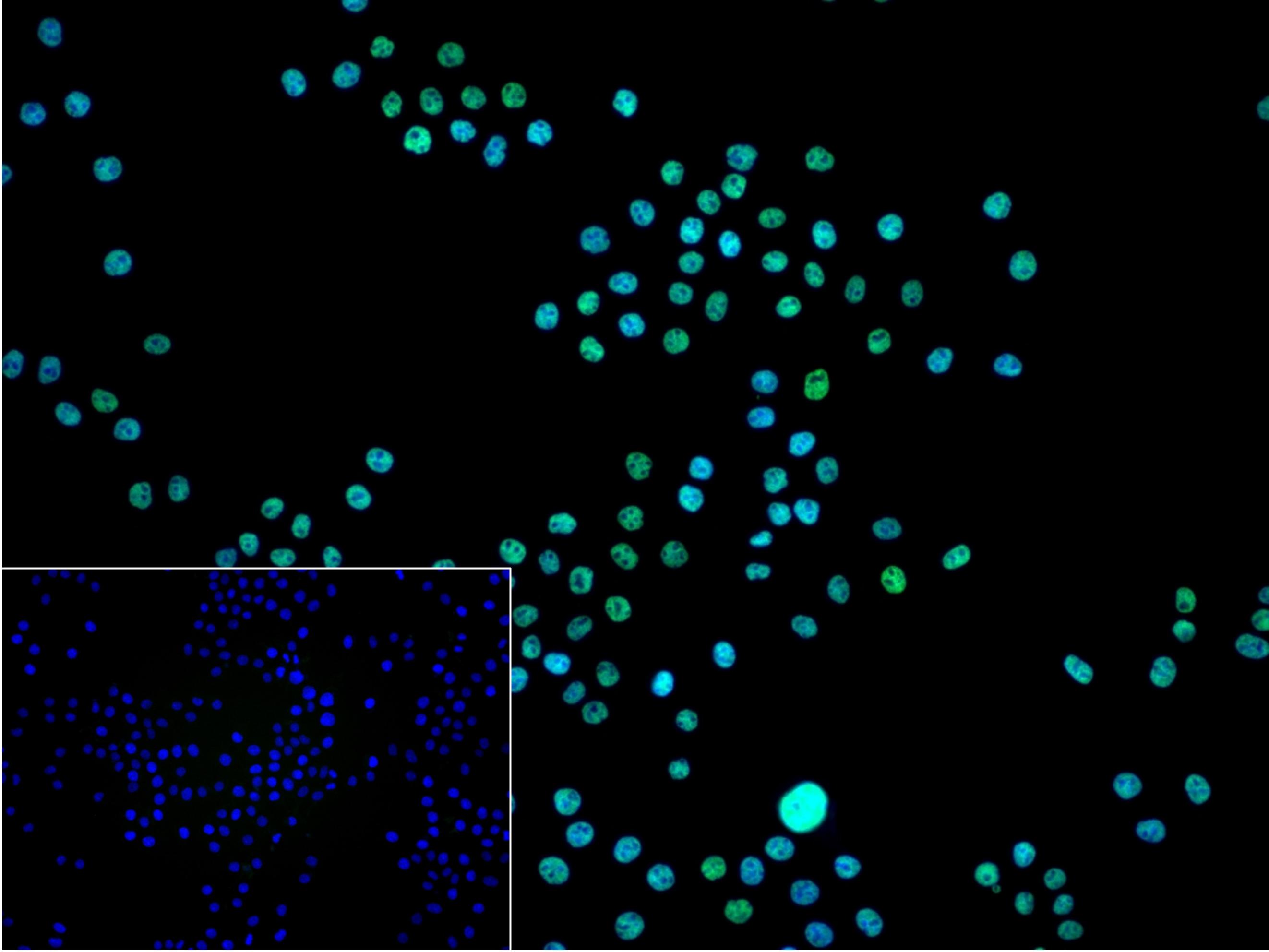 DNA解旋酶V重组兔单抗-bsm-60625R