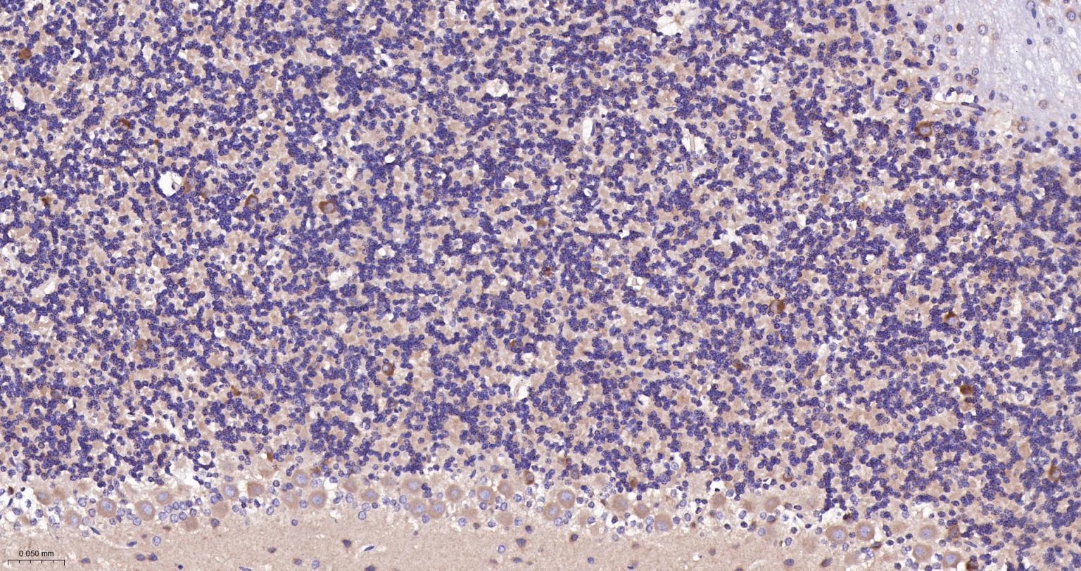 神经性舞蹈病蛋白重组兔单抗