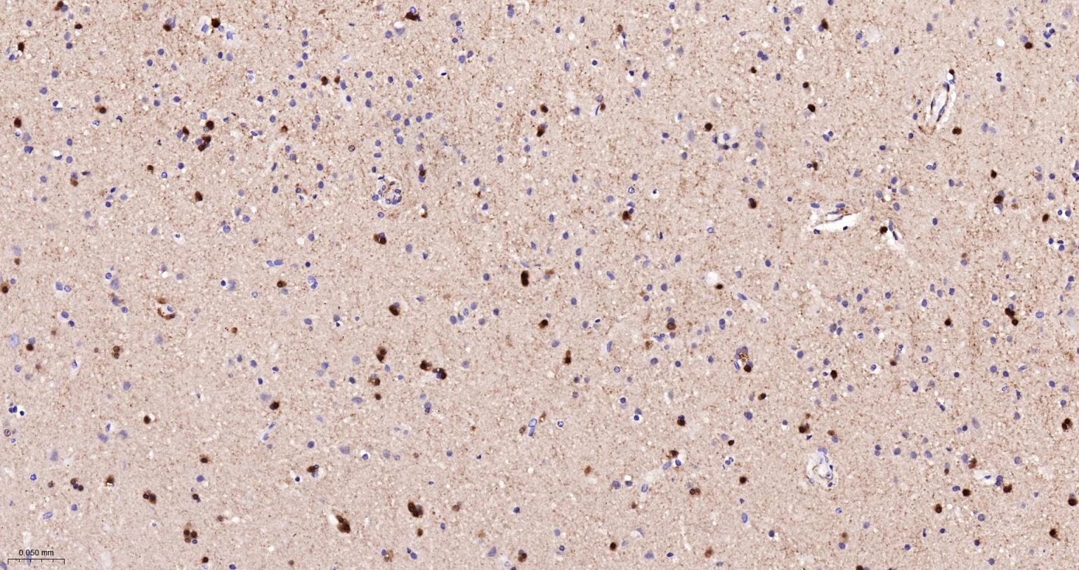 乙酰辅酶A羧化酶重组兔单抗