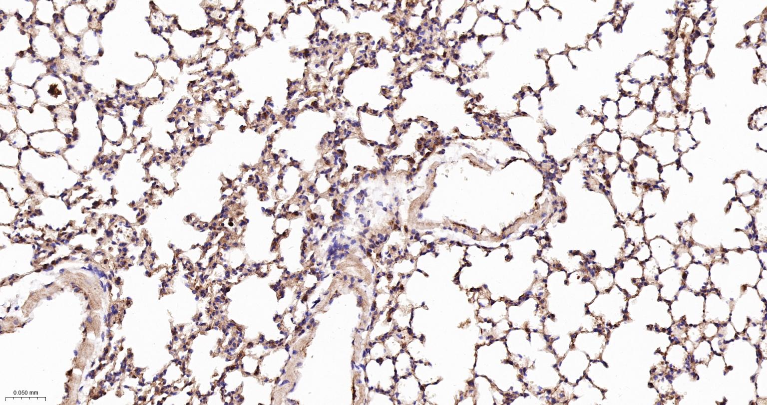乙酰辅酶A羧化酶重组兔单抗