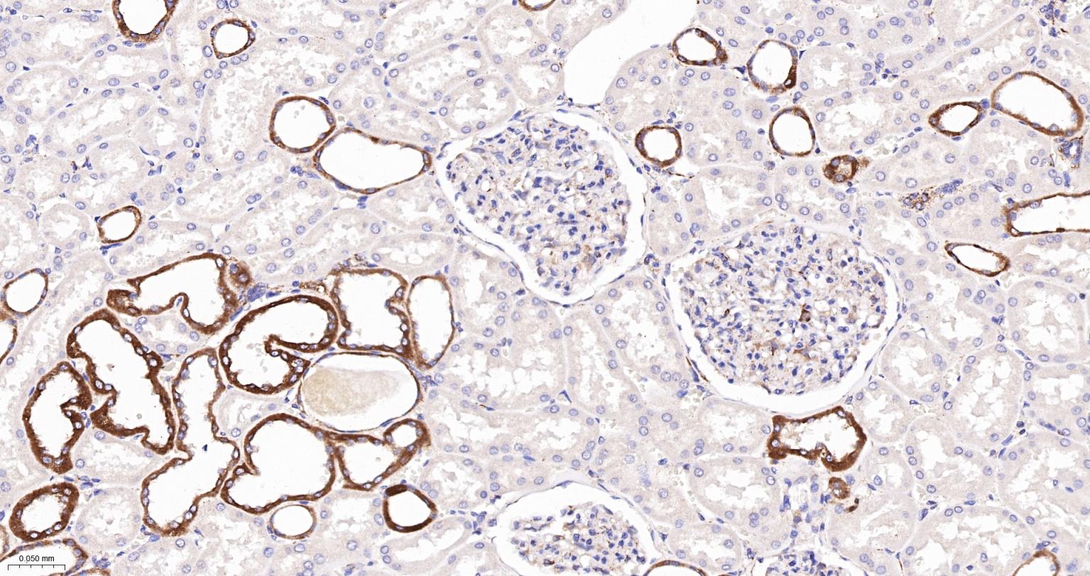 己糖激酶1重组兔单抗