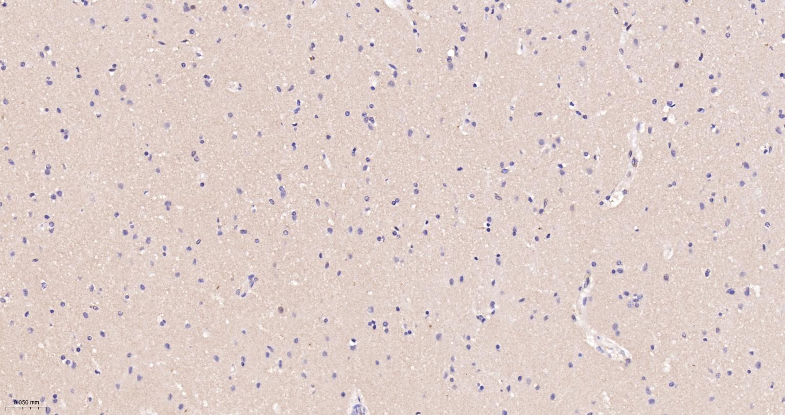 神经性舞蹈病蛋白重组兔单抗