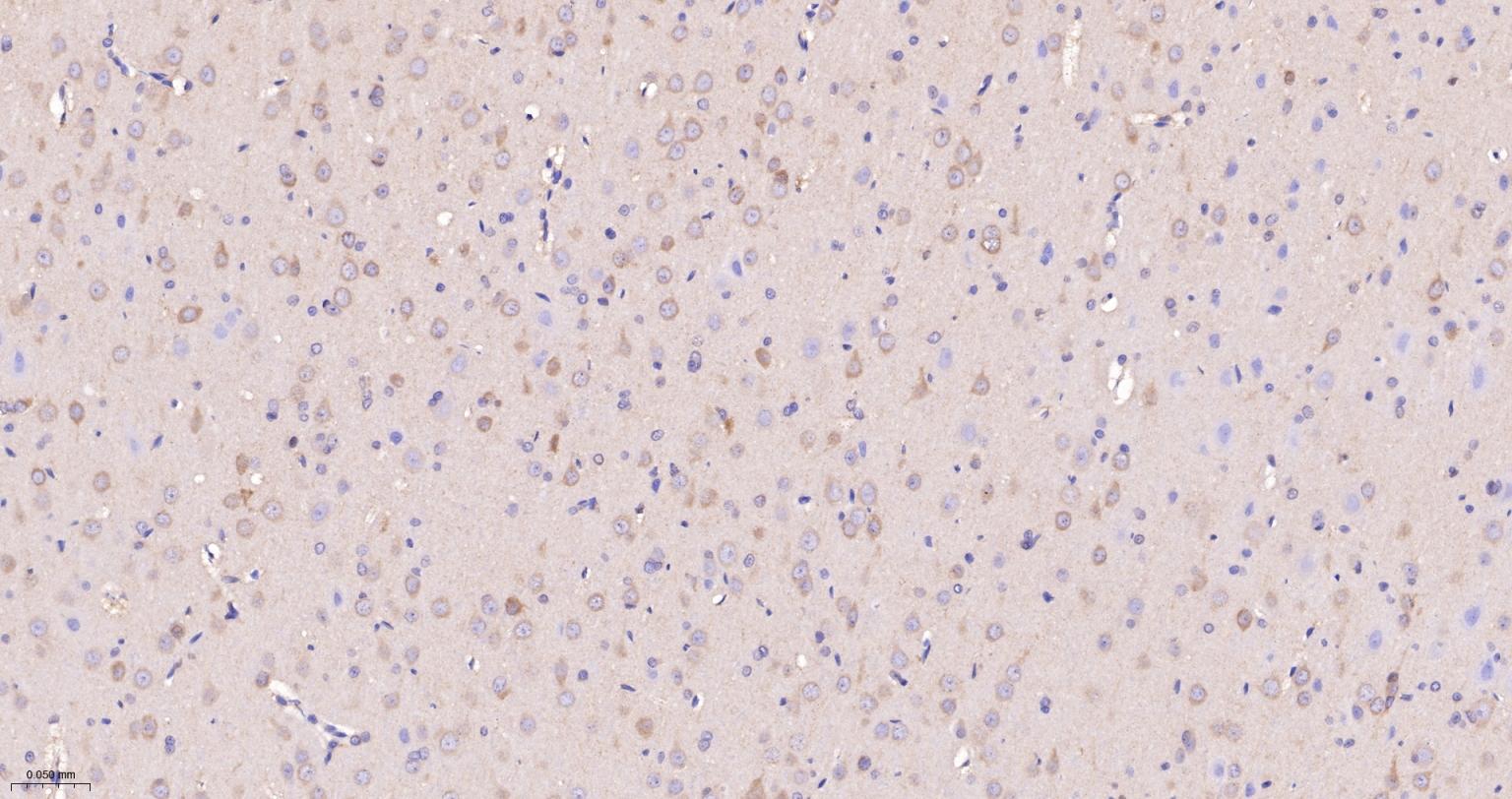 神经性舞蹈病蛋白重组兔单抗