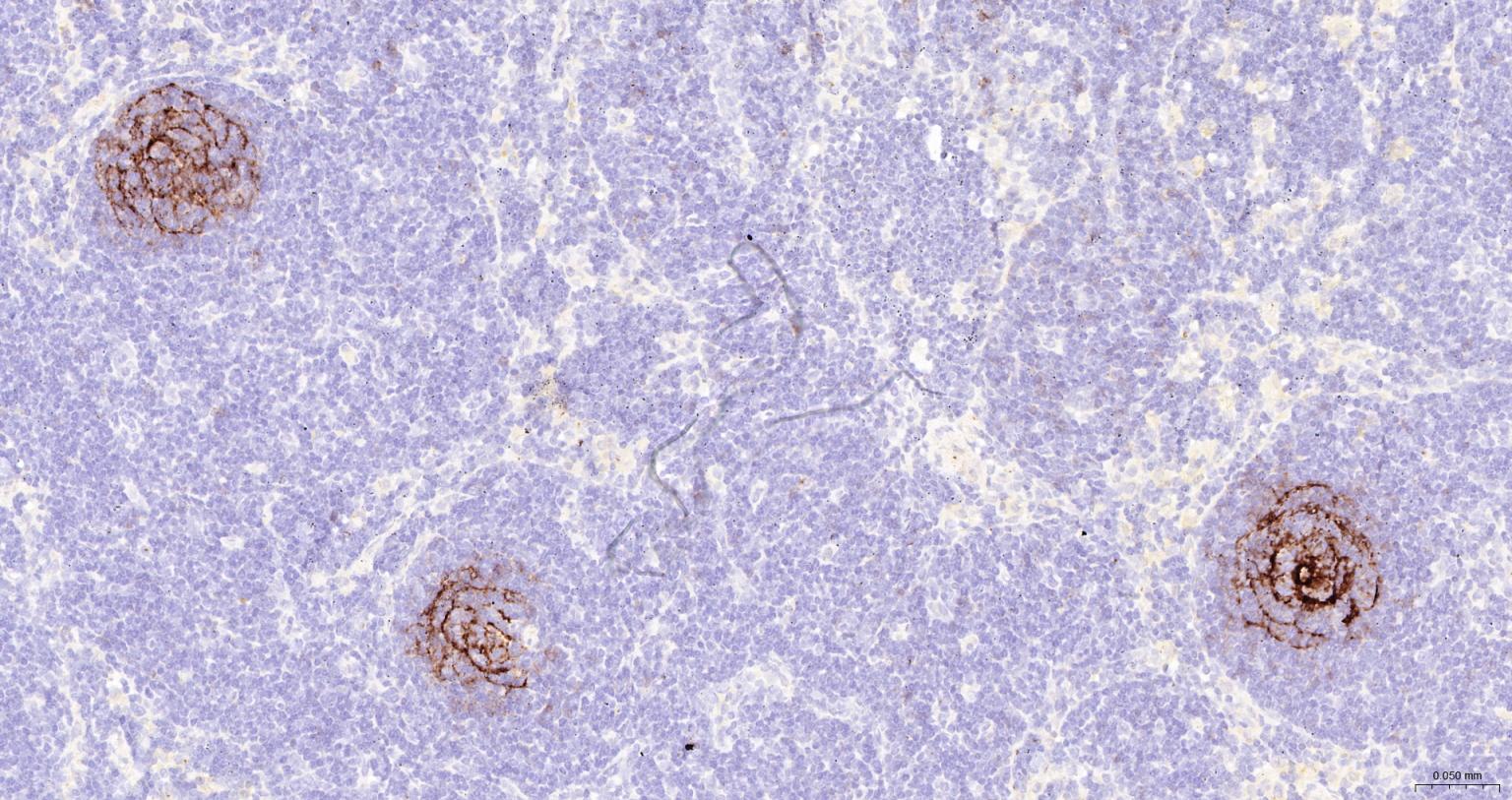 FCER2/CD23单克隆抗体-bsm-43216M