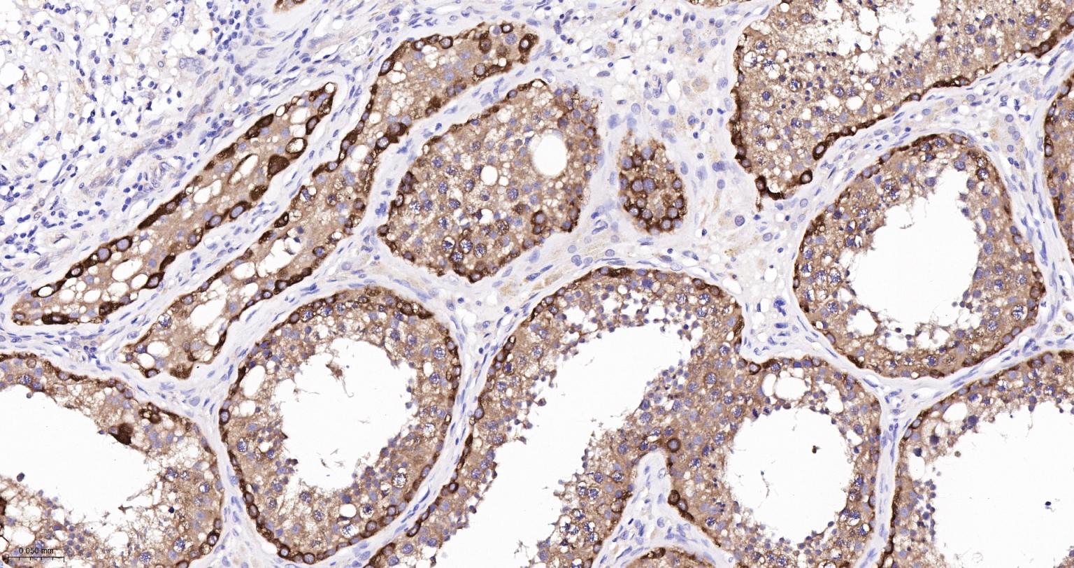 神经性舞蹈病蛋白重组兔单抗
