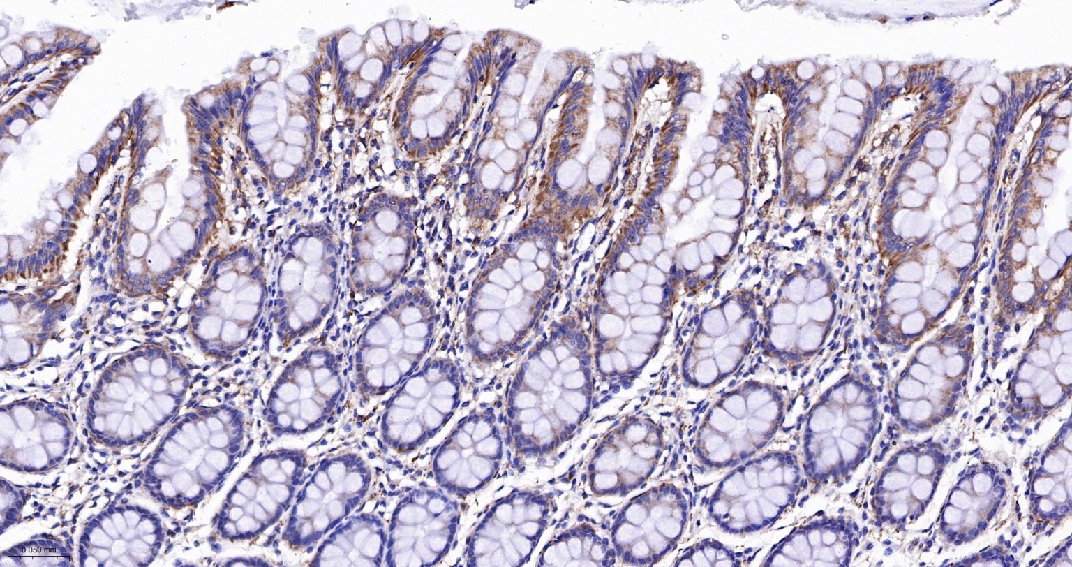 己糖激酶1重组兔单抗