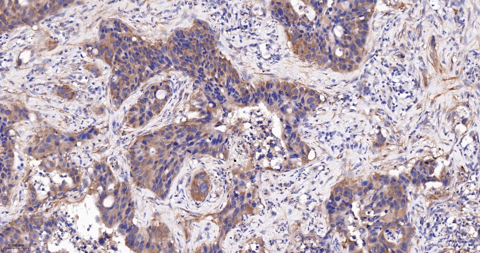 乙酰辅酶A羧化酶重组兔单抗