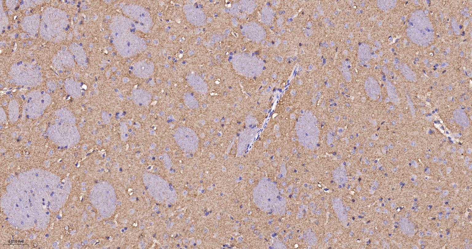 己糖激酶1重组兔单抗