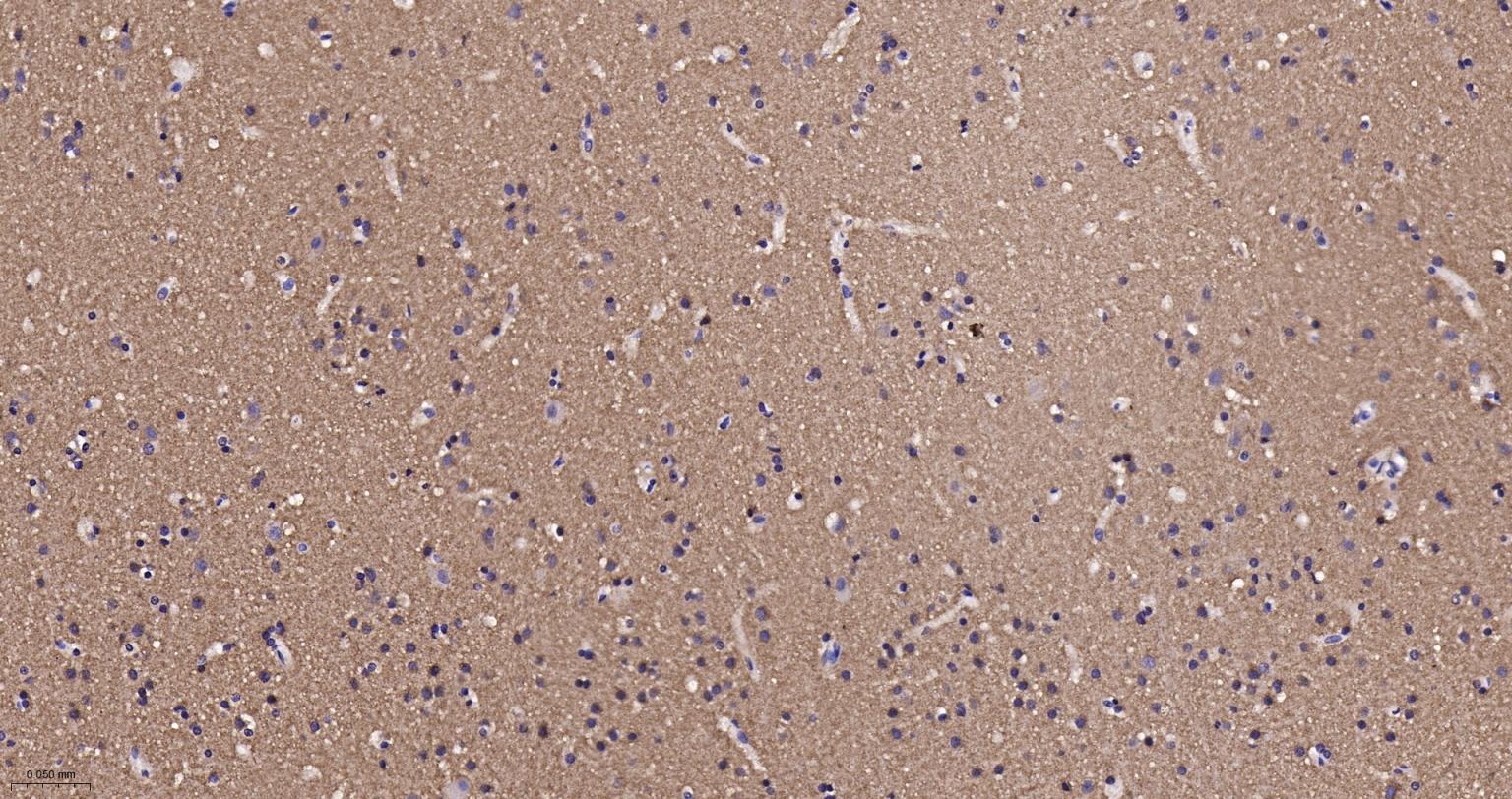 己糖激酶1重组兔单抗