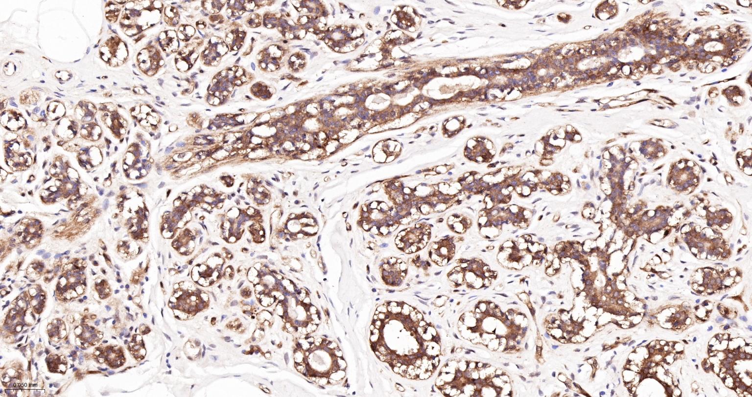 热休克蛋白90β/HSP90 β 重组兔单抗