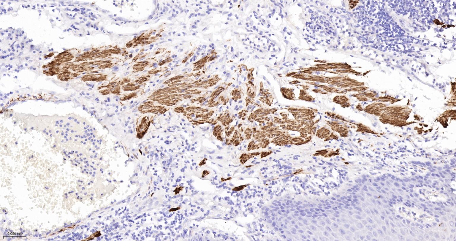 结蛋白重组兔单抗