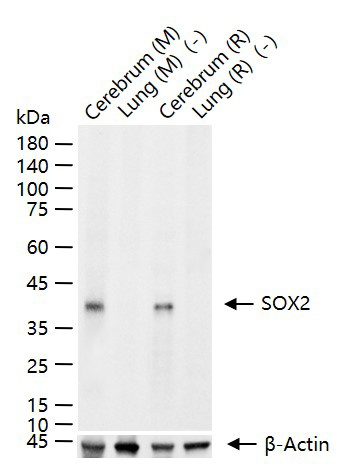 胚胎干细胞关键蛋白重组兔单克隆抗体