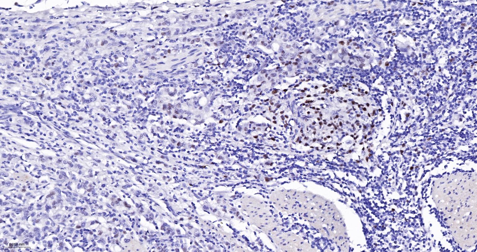 错配修复蛋白6重组兔单抗