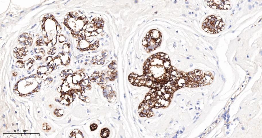 载脂蛋白D重组兔单抗