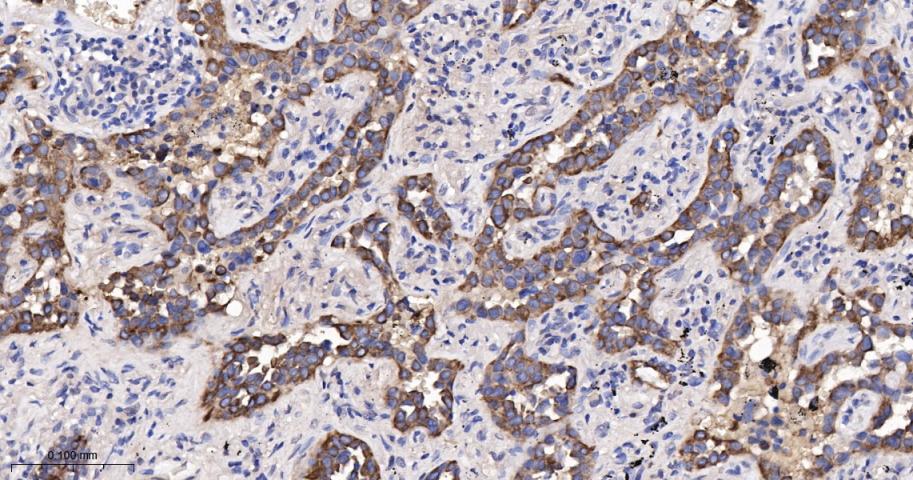 细胞角蛋白18单克隆抗体-bsm-33103M