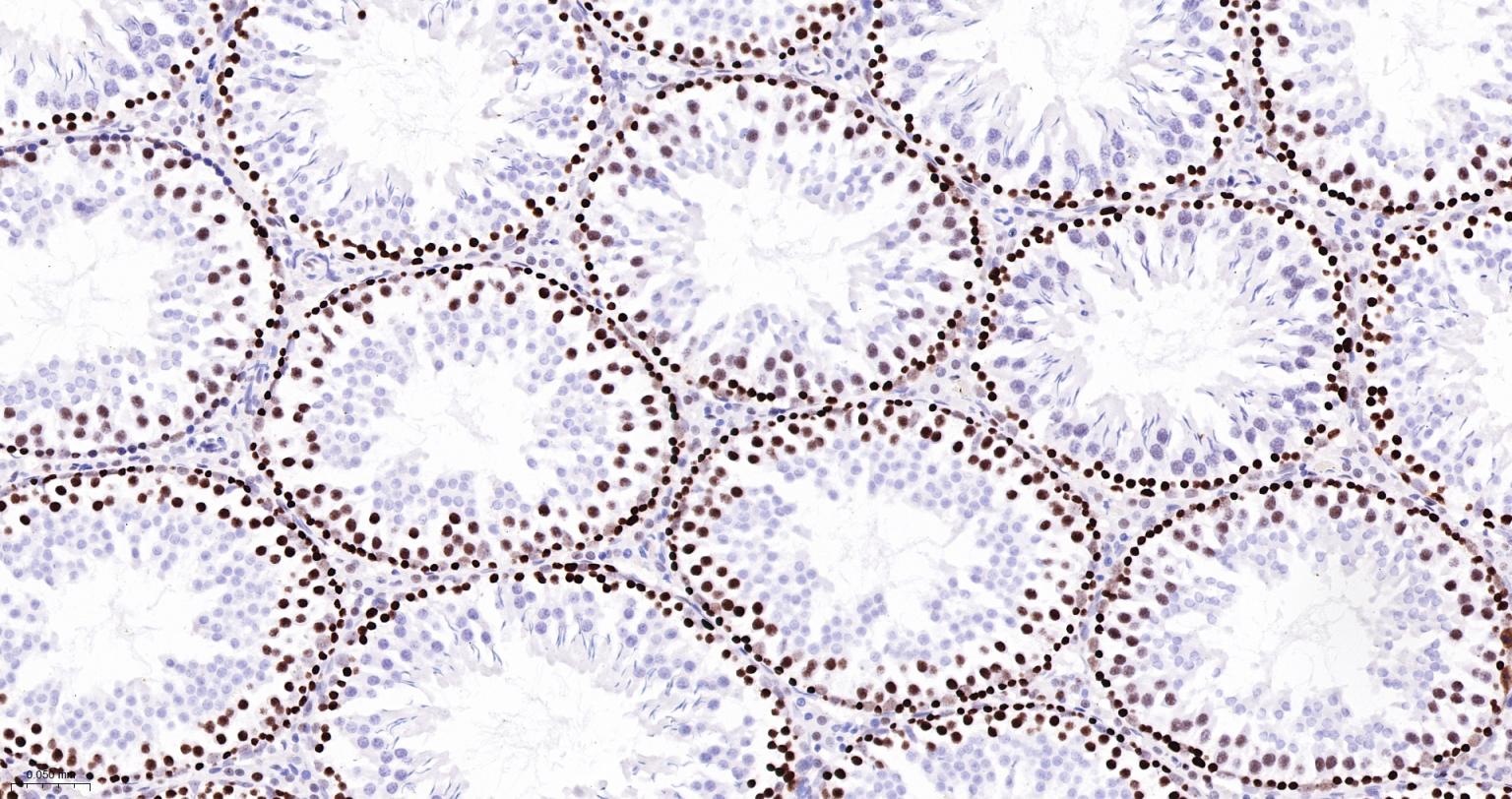 错配修复蛋白6重组兔单抗