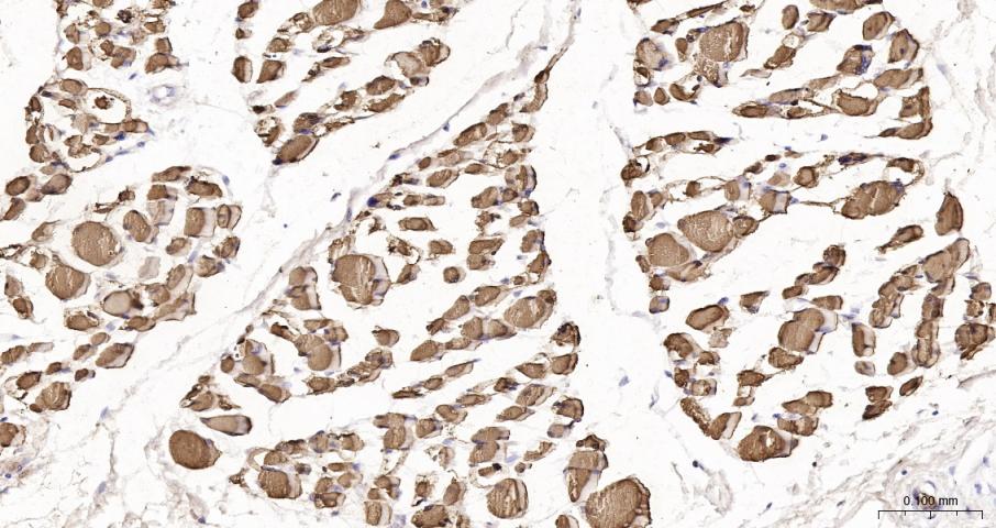 肌红蛋白重组兔单抗