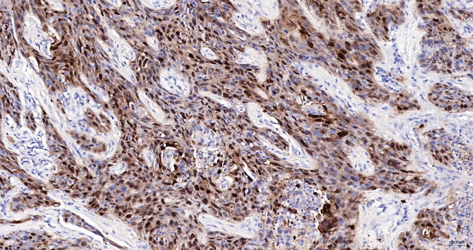 丝氨酸蛋白酶抑制剂B3重组兔单抗