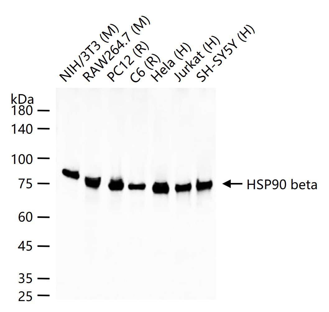 热休克蛋白90β/HSP90 β 重组兔单抗
