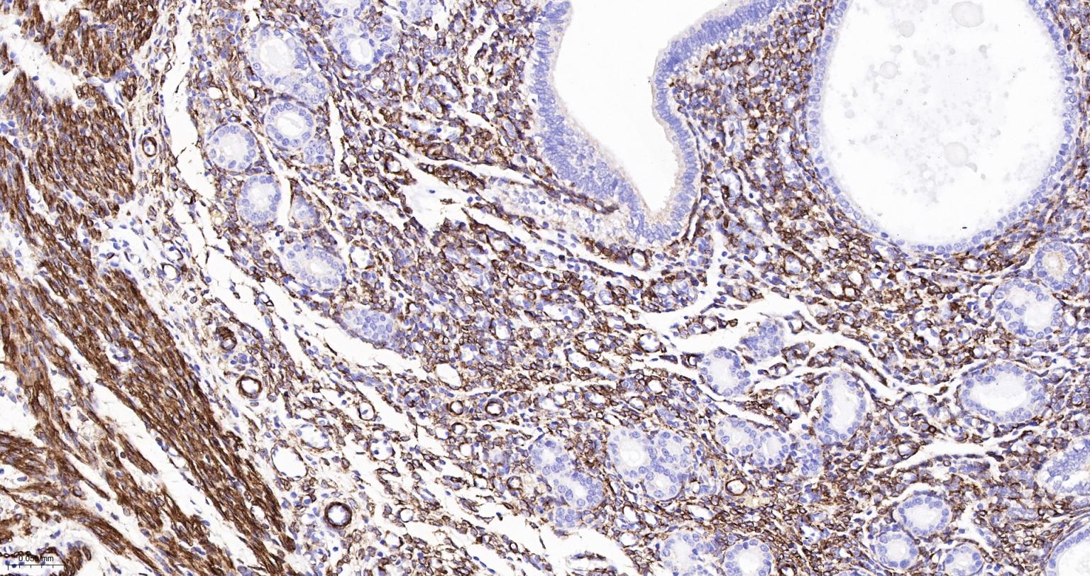 结蛋白重组兔单抗