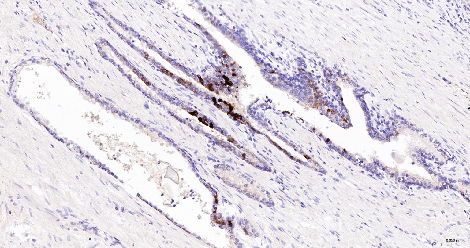 丝氨酸蛋白酶抑制剂B3重组兔单抗