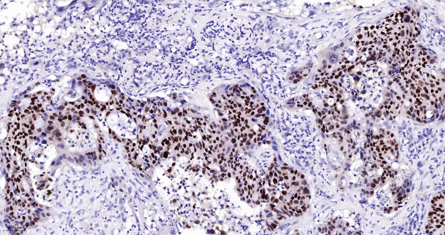 胚胎干细胞关键蛋白重组兔单克隆抗体