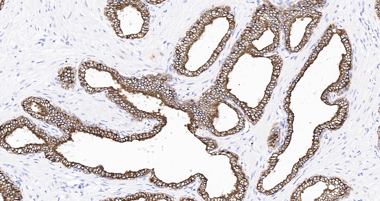 上皮钙粘附分子抗体-bsm-51351M