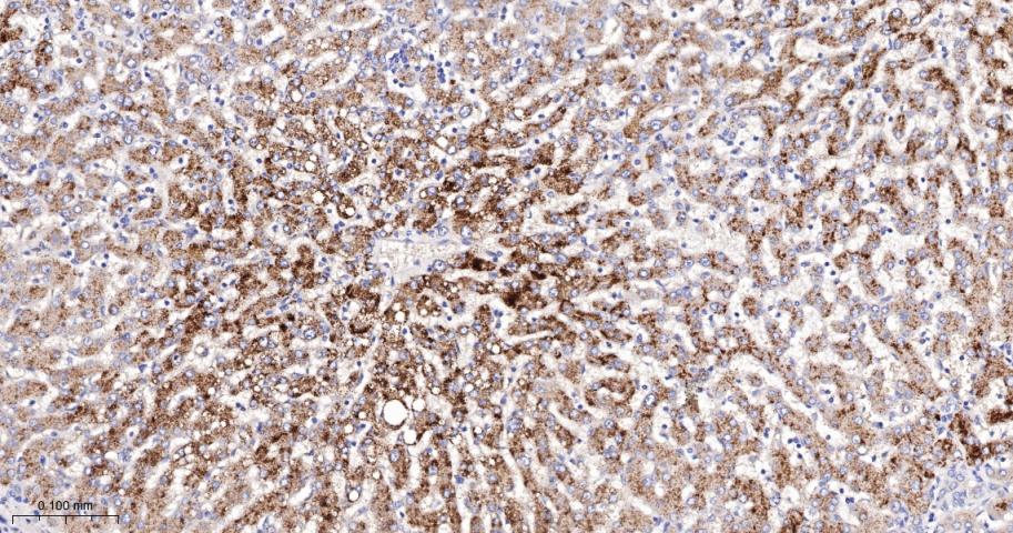 载脂蛋白D重组兔单抗