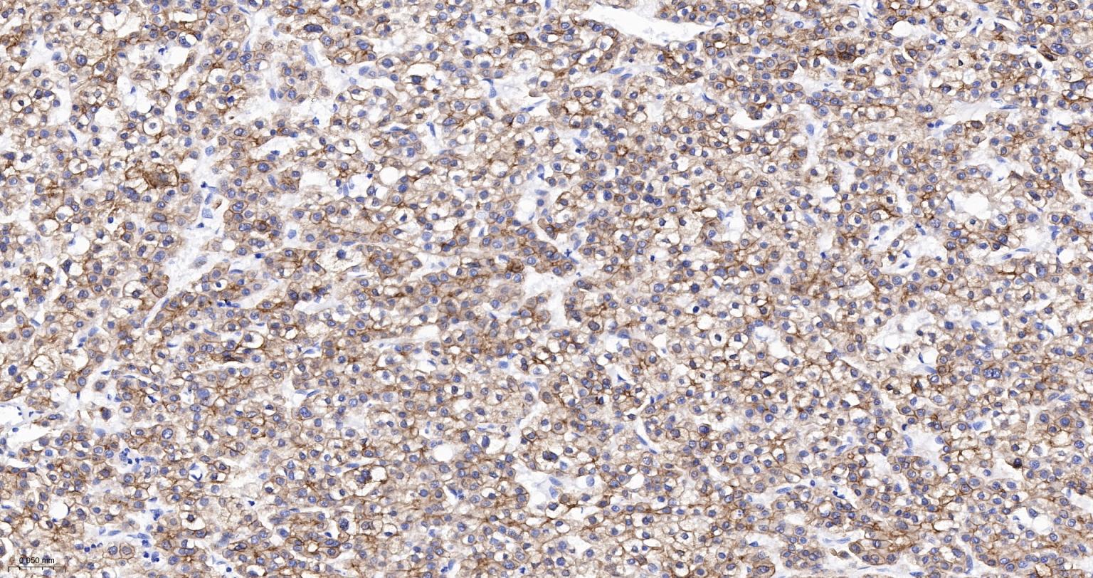 上皮钙粘附分子抗体-bsm-51351M