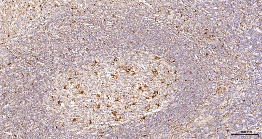 溶酶体相关膜蛋白1（CD107）重组兔单抗