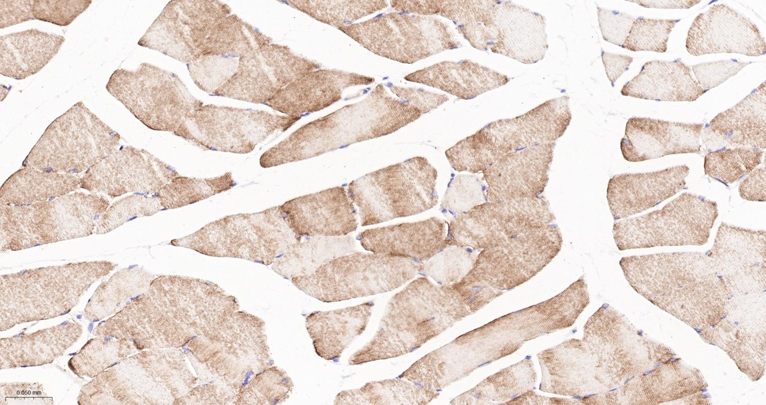 结蛋白重组兔单抗