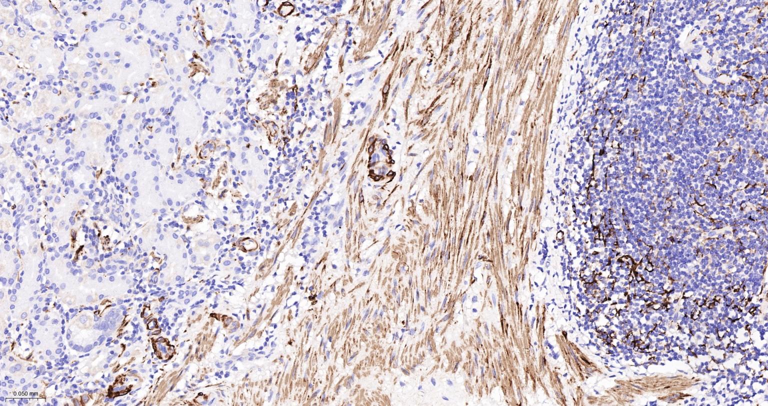 结蛋白重组兔单抗