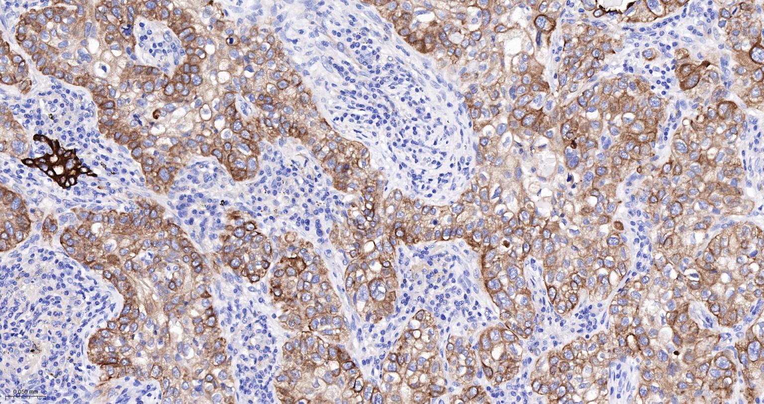 上皮钙粘附分子抗体-bsm-51351M