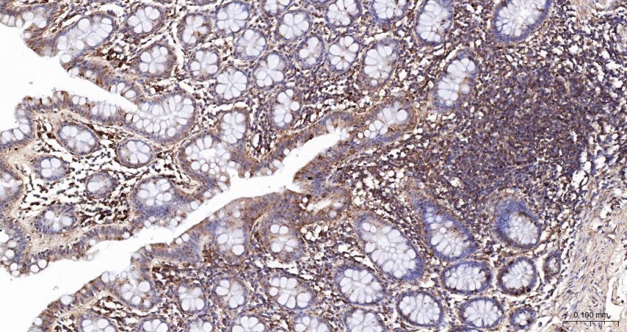 溶酶体相关膜蛋白1（CD107）重组兔单抗