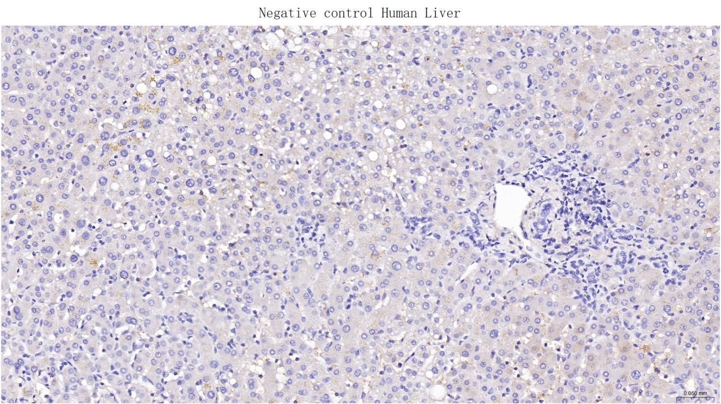 肌红蛋白重组兔单抗