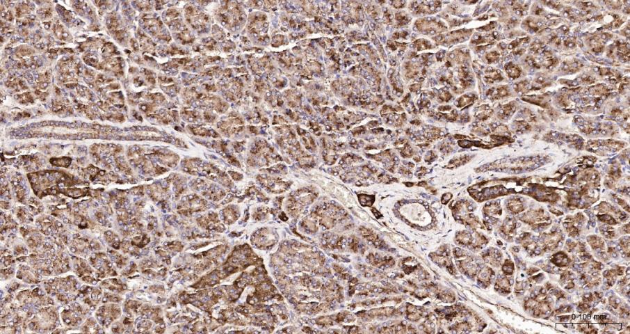 溶酶体相关膜蛋白1（CD107）重组兔单抗