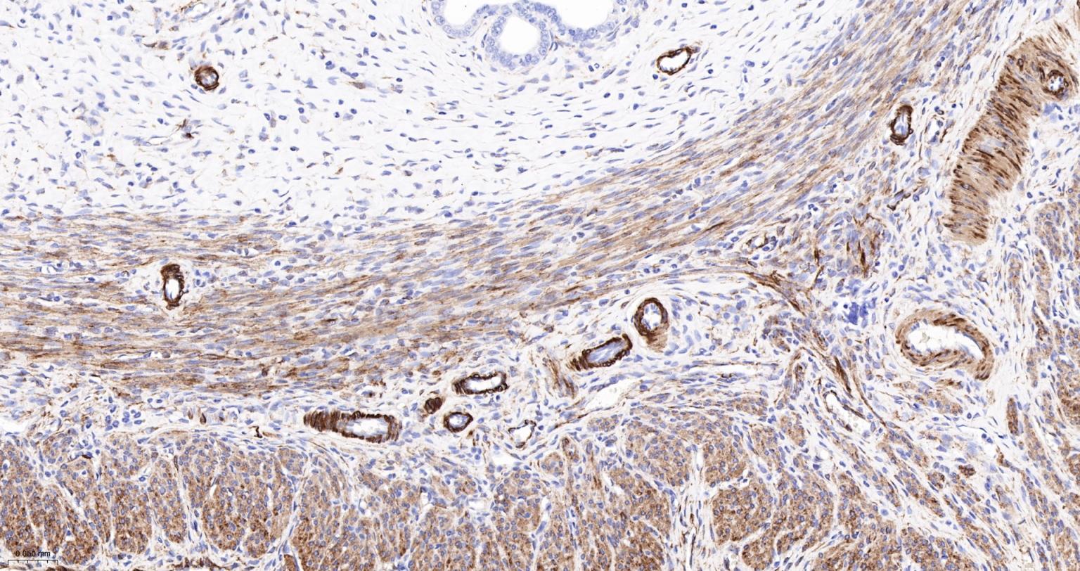 结蛋白重组兔单抗