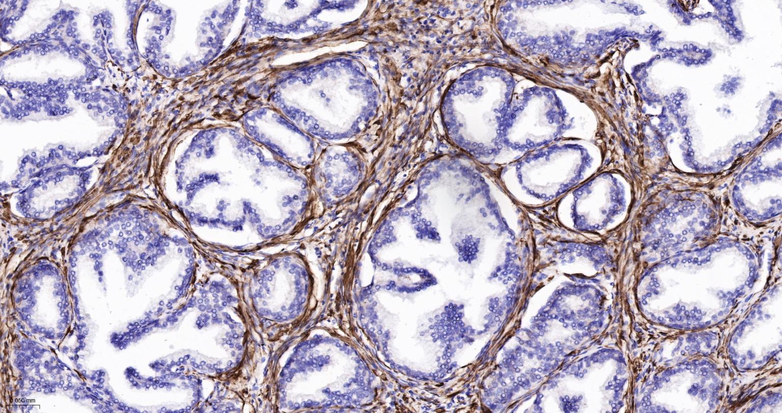 结蛋白重组兔单抗