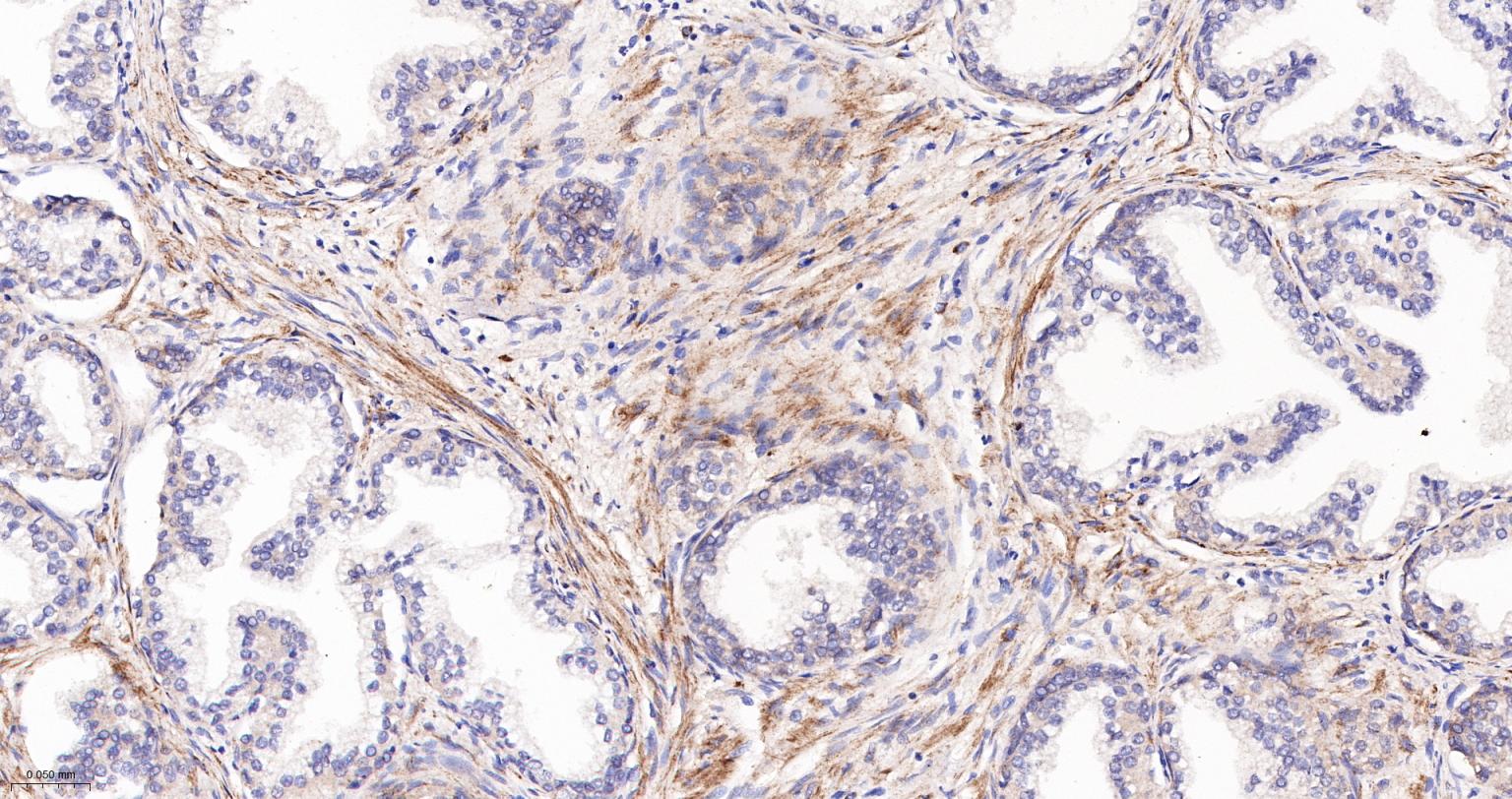 溶血磷脂酸受体蛋白1/EDG2重组兔单抗