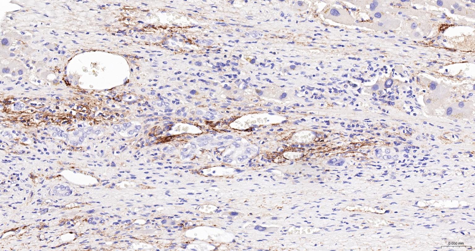 神经生长因子受体重组兔单抗