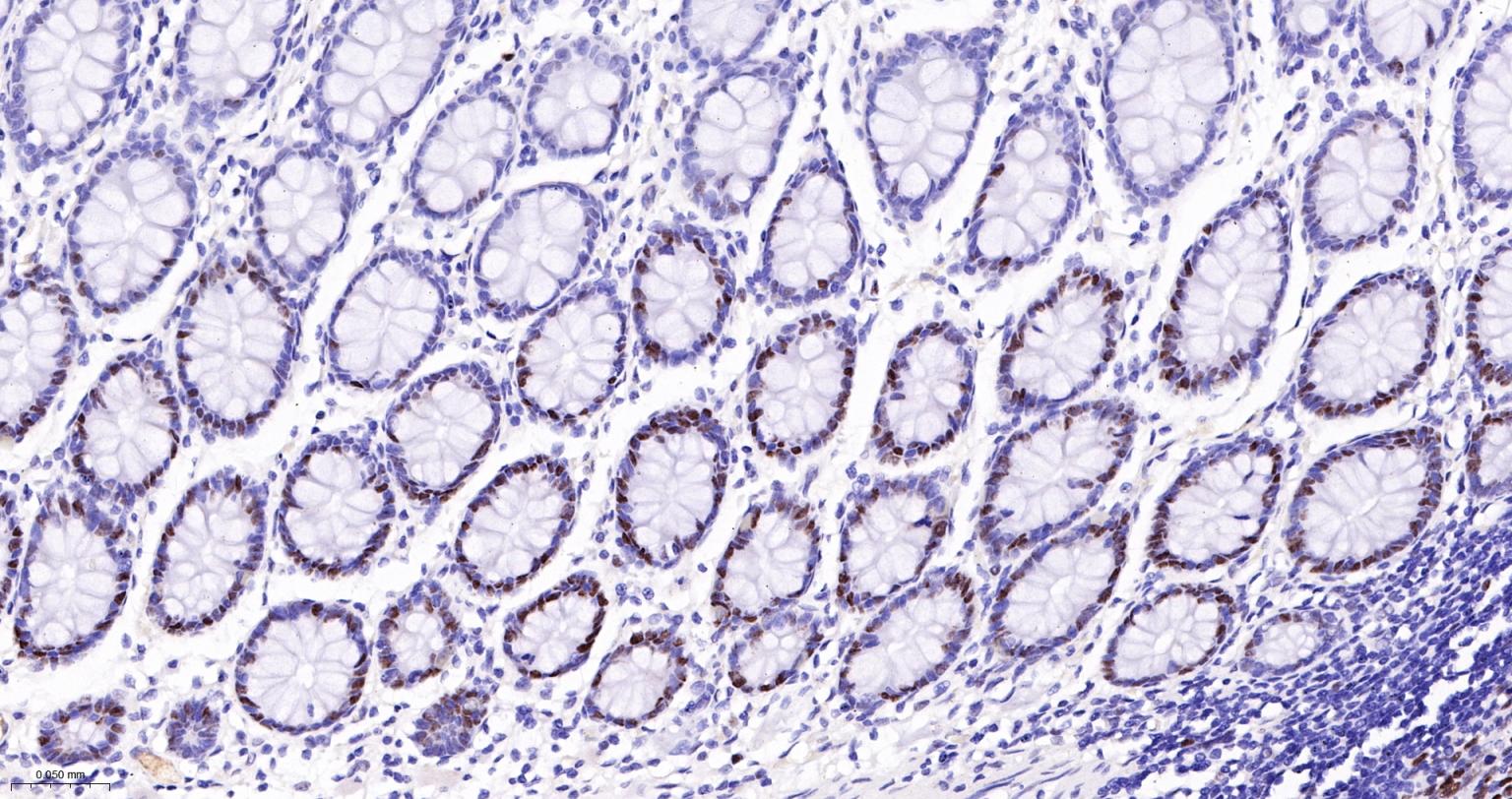 错配修复蛋白6重组兔单抗