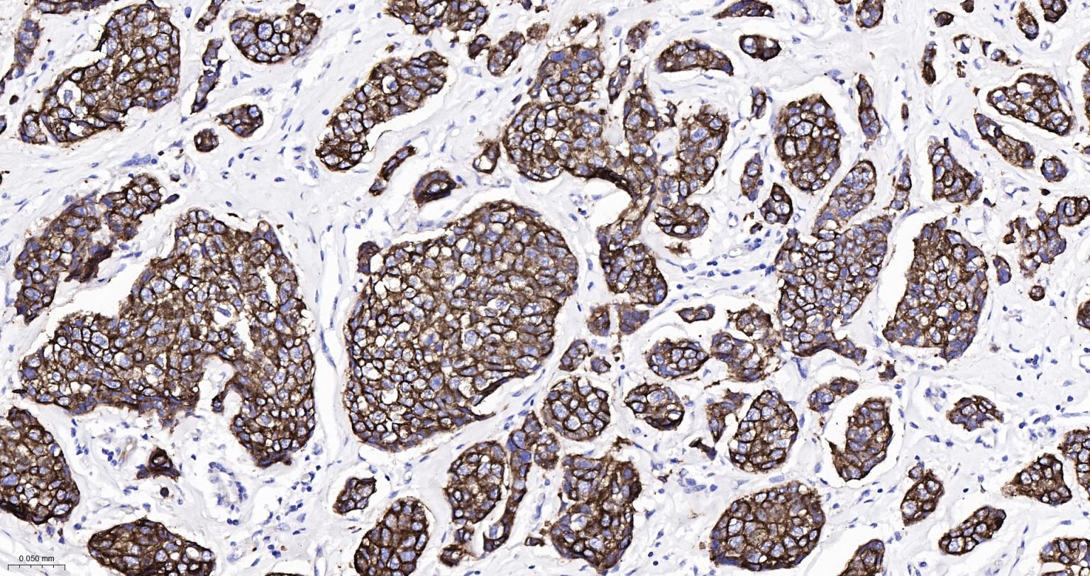 上皮钙粘附分子抗体-bsm-51351M