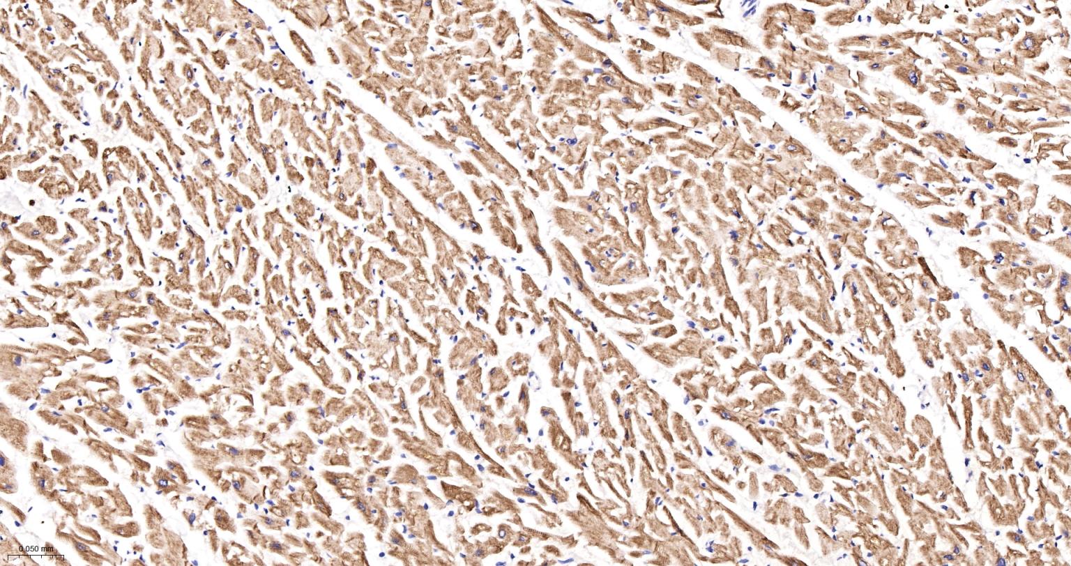 结蛋白重组兔单抗